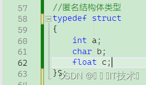 C语言：自定义类型——结构体
